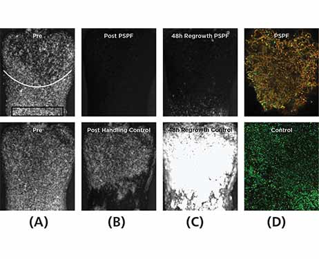 Gingival bleeding index graph
