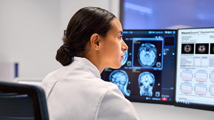 Philips and Cortechs.ai extend partnership to advance quantitative neuroimaging and strengthen Philips&rsquo; leadership in precision diagnostics in neurology